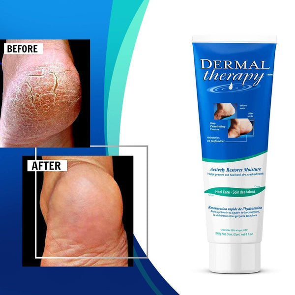 Dermal Therapy Heel Care Cream 240g腳跟龜裂 乾裂 修護 護理霜 240g