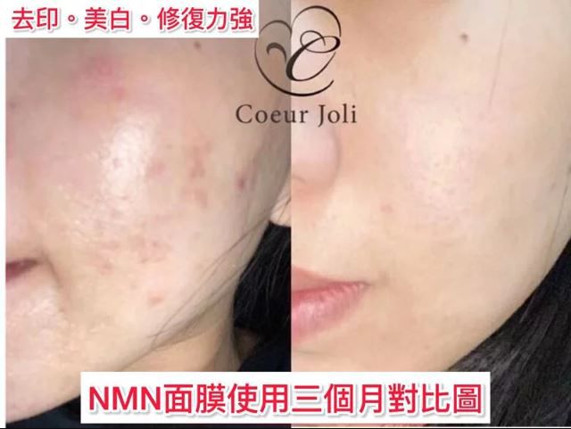 日本製Coeur Joli 高規格『NMN逆齡修復幹細胞面膜』(一盒五入）